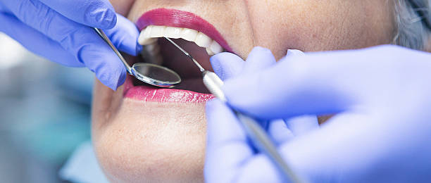 Best Emergency Treatment for Dental Infections or Abscesses in Westfield, IN