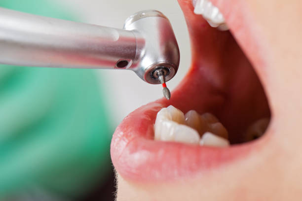 Best Pediatric Emergency Dentist in Westfield, IN